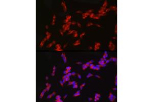 Immunofluorescence analysis of SH-SY5Y cells using nNOS Rabbit mAb (ABIN1680436, ABIN1680435, ABIN7101483 and ABIN7101484) at dilution of 1:100 (40x lens). (NOS1 antibody)