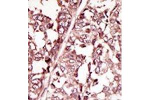 Image no. 2 for anti-C-Ros Oncogene 1 , Receptor tyrosine Kinase (ROS1) (AA 33-63), (N-Term) antibody (ABIN359936) (ROS1 antibody  (N-Term))