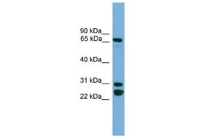 WB Suggested Anti-DNAI2 Antibody Titration:  0.