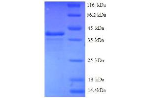 SDS-PAGE (SDS) image for Eukaryotic Translation Initiation Factor 1 (EIF1) (AA 1-113), (full length) protein (GST tag) (ABIN4974328) (EIF1 Protein (AA 1-113, full length) (GST tag))