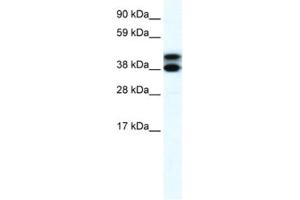 Western Blotting (WB) image for anti-Tripartite Motif Containing 13 (TRIM13) antibody (ABIN2460875) (TRIM13 antibody)