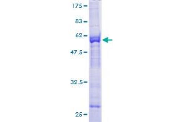 KLHDC3 Protein (AA 1-266) (GST tag)