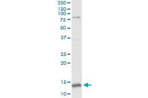 GLRX5 monoclonal antibody (M04), clone 4G8. (GLRX5 antibody  (AA 1-157))