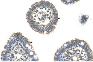 Human Intestine (UBE2L3 antibody  (C-Term))