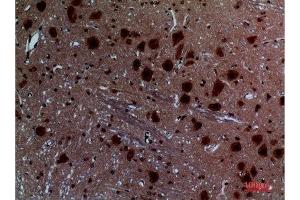 Immunohistochemistry (IHC) analysis of paraffin-embedded Rat Brain, antibody was diluted at 1:100. (Layilin antibody  (Internal Region))