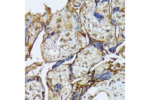 Immunohistochemistry of paraffin-embedded human placenta using D antibody (ABIN7266712) at dilution of 1:100 (40x lens).