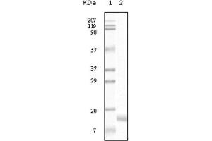 Western Blotting (WB) image for anti-Synuclein, gamma (Breast Cancer-Specific Protein 1) (SNCG) antibody (ABIN1845097) (SNCG antibody)