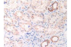IHC-P analysis of Human Kidney Tissue, with DAB staining. (HSPD1 antibody  (AA 172-343))