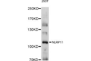 Western blot analysis of extracts of 293T cells, using NLRP11 antibody (ABIN6131484, ABIN6144660, ABIN6144661 and ABIN6215714) at 1:1000 dilution. (NLRP11 antibody  (AA 420-600))