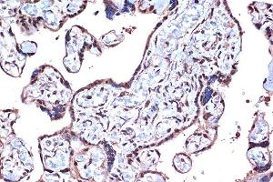Immunohistochemistry of paraffin-embedded human placenta using PDCD4 Rabbit mAb  at dilution of 1:100 (40x lens). (PDCD4 antibody)