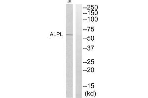 Western blot analysis of extracts from Jurkat cells, using ALPL antibody. (ALPL antibody  (Internal Region))