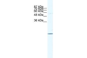 WB Suggested Anti-E2F6 Antibody   Titration: 1. (E2F6 antibody  (Middle Region))