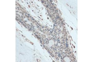 Immunohistochemistry of paraffin-embedded human breast using antibody (ABIN6130837, ABIN6140958, ABIN6140959 and ABIN6214740) at dilution of 1:100 (40x lens). (GAPDHS antibody  (AA 179-408))