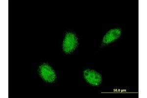 Immunofluorescence (IF) image for anti-Retinoid X Receptor, alpha (RXRA) (AA 1-165) antibody (ABIN519935)