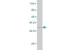Western Blot detection against Immunogen (35. (MYL5 antibody  (AA 4-96))