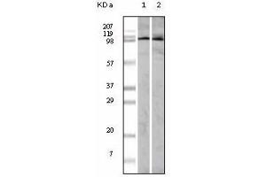 Western Blotting (WB) image for anti-Ephrin Type A Receptor 1 (EPHA1) antibody (ABIN1107101)