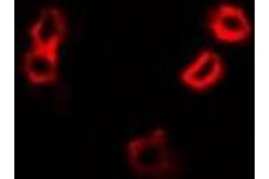 Immunofluorescent analysis of HAX1 staining in A549 cells. (HAX1 antibody)