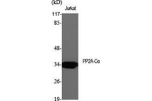 Western Blot (WB) analysis of specific cells using PP2A-Calpha Polyclonal Antibody. (PPP2CA antibody  (Thr278))