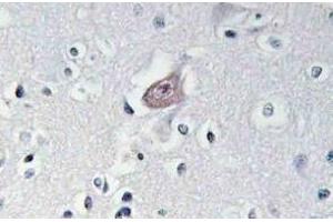 Immunohistochemistry (Paraffin-embedded Sections) (IHC (p)) image for anti-C-Abl Oncogene 1, Non-Receptor tyrosine Kinase (ABL1) (pTyr393), (pTyr439) antibody (ABIN498716)