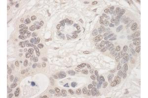 anti-THO Complex 2 (THOC2) (AA 1543-1593) antibody