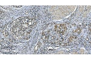 IHC analysis of LSM7 using anti-LSM7 antibody (ABIN7598937). (LSM7 antibody  (AA 1-103))