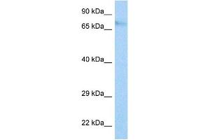 Host:  Rabbit  Target Name:  IFI204  Sample Tissue:  Mouse NIH3T3 Whole Cell  Antibody Dilution:  1ug/ml (Ifi204 antibody  (Middle Region))