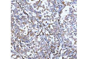 IHC analysis of Hsp47/SERPINH1 using anti-Hsp47/SERPINH1 antibody (ABIN3043331). (SERPINH1 antibody  (AA 247-418))