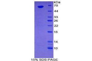 SDS-PAGE (SDS) image for Sulfatase 1 (SULF1) (AA 609-871) protein (His tag,GST tag) (ABIN2123623) (SULF1 Protein (AA 609-871) (His tag,GST tag))