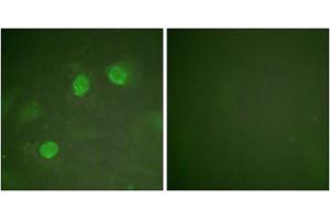 Immunofluorescence analysis of HeLa cells, using GATA3 antibody. (GATA3 antibody)