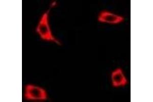 Immunofluorescent analysis of Transcobalamin-1 staining in U2OS cells. (TCN1 antibody)