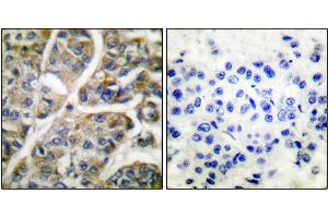 Immunohistochemistry (IHC) image for anti-Granzyme B (GZMB) antibody (ABIN6241151)