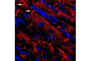 Expression of NaV1. (SCN5A antibody  (Intracellular))