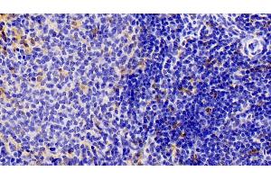 Detection of IBA1 in Rat Spleen Tissue using Polyclonal Antibody to Ionized Calcium-binding Adapter Molecule 1 (IBA1) (Iba1 antibody  (AA 1-147))