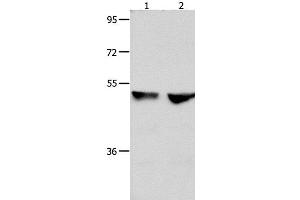 Western Blot analysis of 823 and Hela cell using CDK9 Polyclonal Antibody at dilution of 1:300 (CDK9 antibody)