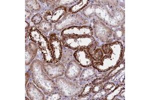 Immunohistochemical staining of human kidney with IL20RA polyclonal antibody  shows strong cytoplasmic positivity in renal tubules at 1:200-1:500 dilution. (IL20RA antibody)