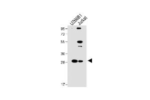 All lanes : Anti-LTM5 Antibody (N-term) at 1:1000 dilution Lane 1: U266B1 whole cell lysate Lane 2: Jurkat whole cell lysate Lysates/proteins at 20 μg per lane. (LAPTM5 antibody  (N-Term))