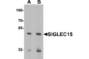 Western blot analysis of SIGLEC15 in Rat kidney tissue lysate with SIGLEC15 antibody at (A) 1 and (B) 2 µg/mL (SIGLEC15 antibody  (N-Term))
