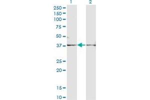 Western Blot analysis of FST expression in transfected 293T cell line by FST monoclonal antibody (M01A), clone 1G4. (Follistatin antibody  (AA 1-344))