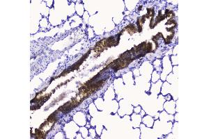 IHC analysis of COX IV using anti-COX IV antibody . (COX IV antibody  (AA 59-169))