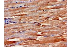Immunohistochemistry of paraffin-embedded human skeletal muscle tissue using ABIN7152499 at dilution of 1:100 (FBXW2 antibody  (AA 72-340))