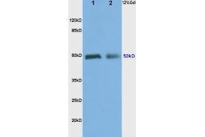 L1 rat kidney lysates, L2 rat brain lysates probed (ABIN737091) Anti-ADRA2 Polyclonal, Unconjugated at 1:200 in 4 °C.