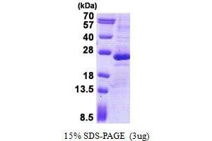 Image no. 1 for Gremlin 1 (GREM1) protein (His tag) (ABIN1098774) (GREM1 Protein (His tag))