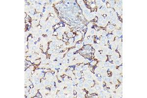 Immunohistochemistry (IHC) image for anti-CD34 (CD34) antibody (ABIN7266187)