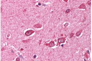 Human Brain, Cortex (formalin-fixed, paraffin-embedded) stained with TRIM38 antibody ABIN213724 at 2. (TRIM38 antibody  (C-Term))