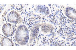 Detection of CASP6 in Bovine Colon Tissue using Monoclonal Antibody to Caspase 6 (CASP6) (Caspase 6 antibody  (AA 81-179))