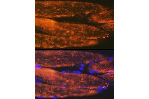 Immunofluorescence analysis of rat bone marrow cells using  Rabbit mAb (ABIN7265398) at dilution of 1:100 (40x lens). (ACTN3 antibody)