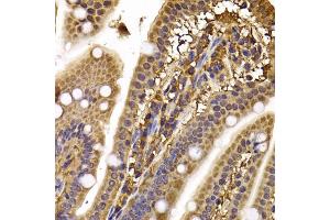 Immunohistochemistry of paraffin-embedded mouse ileum using CLASP1 antibody (ABIN5974258) at dilution of 1/100 (40x lens). (CLASP1 antibody)