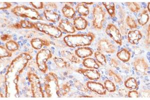 Immunohistochemistry of paraffin-embedded Rat kidney using CYB5A Polyclonal Antibody at dilution of 1:100 (40x lens). (CYB5A antibody)