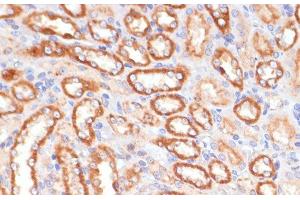 Immunohistochemistry of paraffin-embedded Rat kidney using CYB5A Polyclonal Antibody at dilution of 1:100 (40x lens).