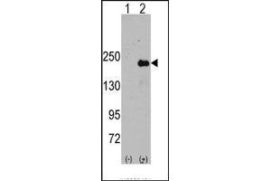 Western blot analysis of SPAG9 (arrow) using rabbit polyclonal SPAG9 Antibody (SPAG9 antibody  (Middle Region))